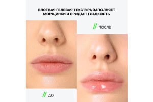 CRYOPLUMP 