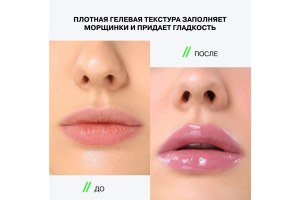 CRYOPLUMP 
